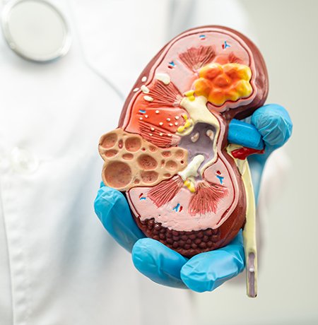 Glomerular Complications